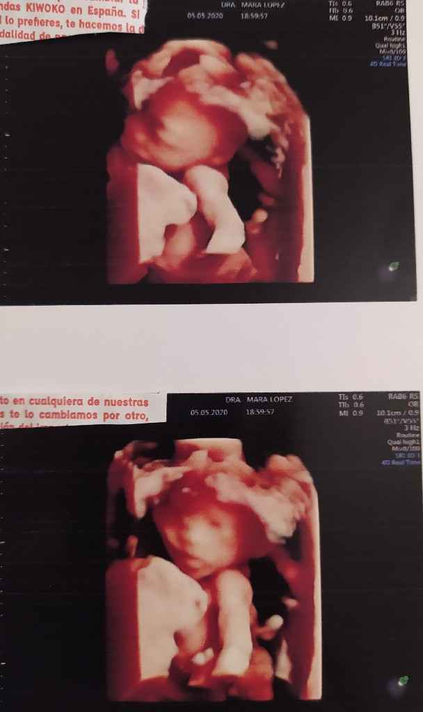 Futuras mamas octubre 2020 - 1
