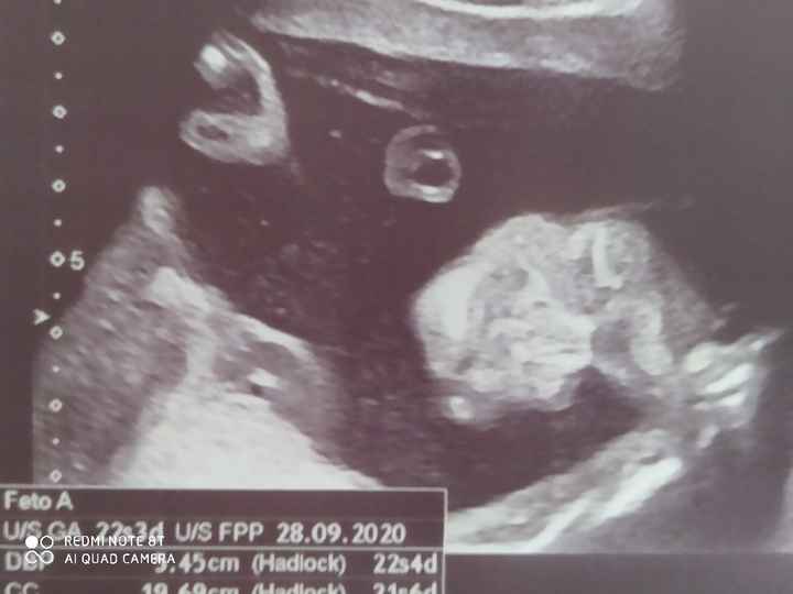 Futuras mamas octubre 2020 - 1