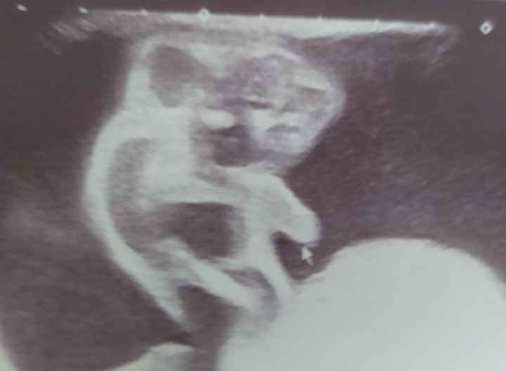 Futuras mamas octubre 2020 - 2
