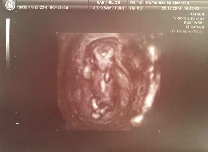 El consultorio de Lita para futuras mamis - 1