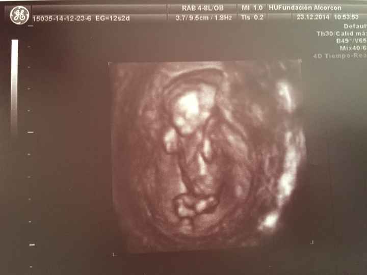 El consultorio de Lita para futuras mamis - 3