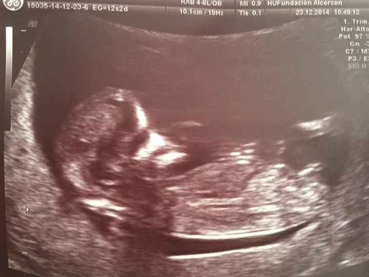 El consultorio de Lita para futuras mamis - 4