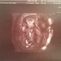 El consultorio de Lita para futuras mamis - 1