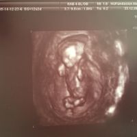 El consultorio de Lita para futuras mamis - 3
