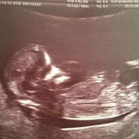 El consultorio de Lita para futuras mamis - 4