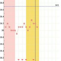 Buscadoras con síndrome de ovario poliquístico (sop) - 1