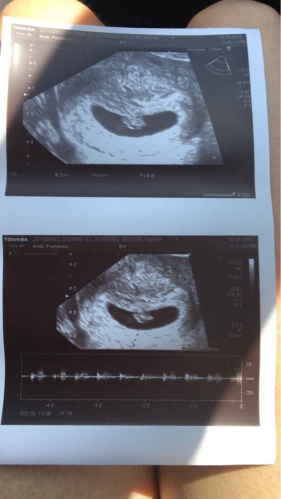 Futuras mamás abril 2017 - 1