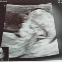 Futuras mamás Mayo 2021🤰♥️ - 1