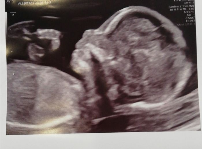 Futuras mamas octubre 2020 - 1