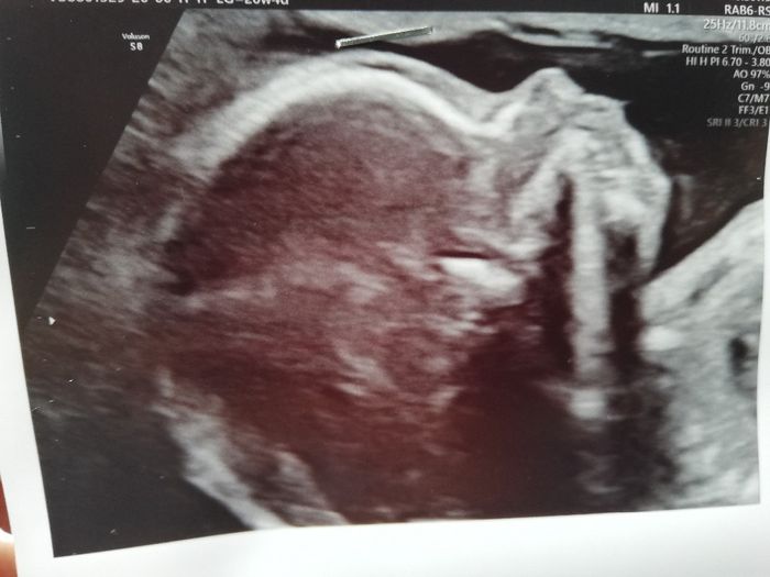 Futuras mamas octubre 2020 - 1
