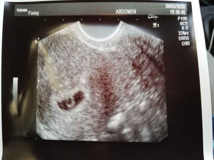 Futuras mamas octubre 2020 - 1