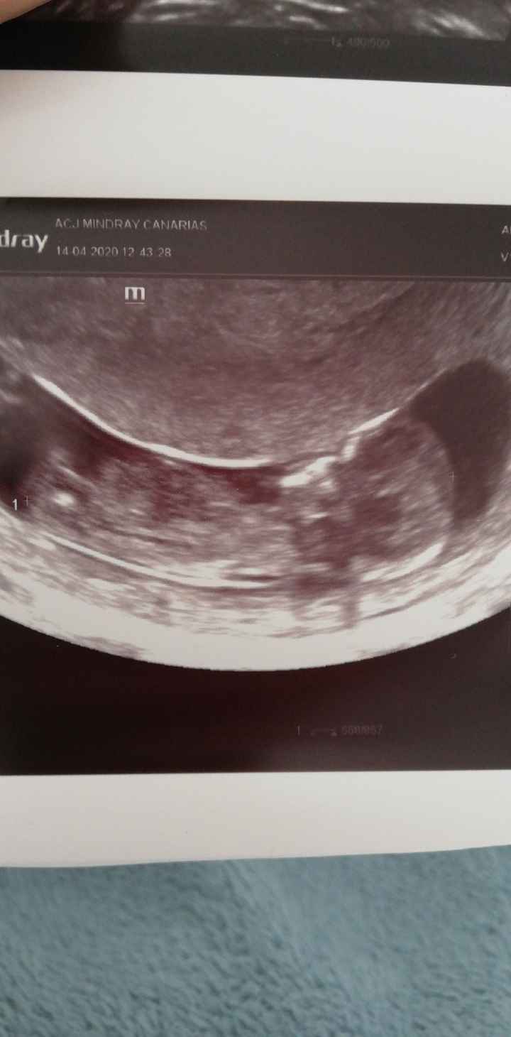 Futuras mamas octubre 2020 - 1