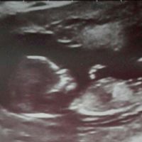 Niño o niña? Eco de 12 semanas - 1