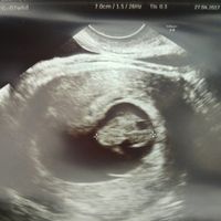 Futuras mamis diciembre 2017 - 1