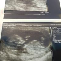 Futuras mamis diciembre 2017 - 1