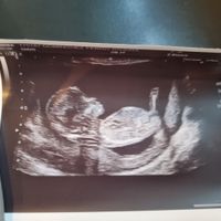 Futuras mamis Junio 2023 - 1