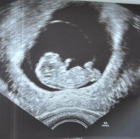 Futuras mamás marzo 2024 - 1