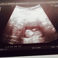 El consultorio de Lita para futuras mamis - 1
