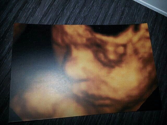 Mi pekeeee!!!!