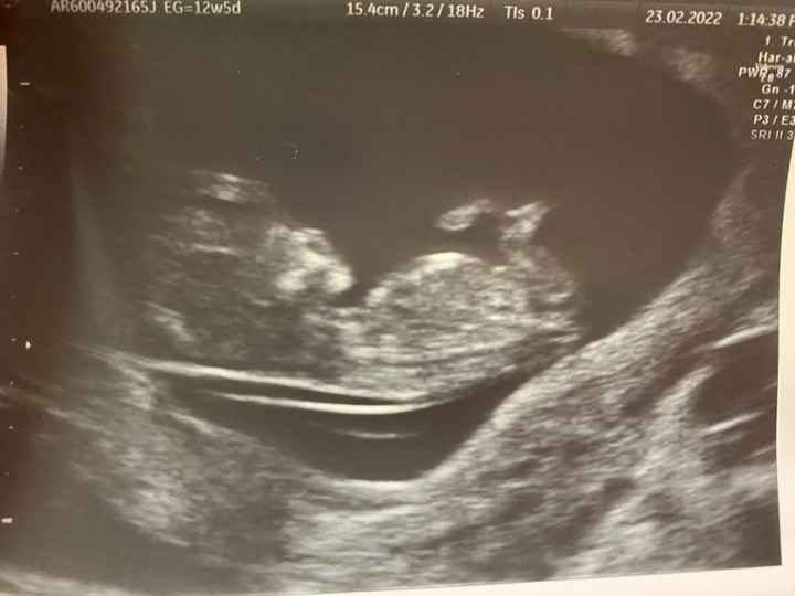 Futuras mamis septiembre 2022!!🤰 - 1