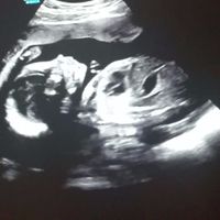 Jan 20 semanas
