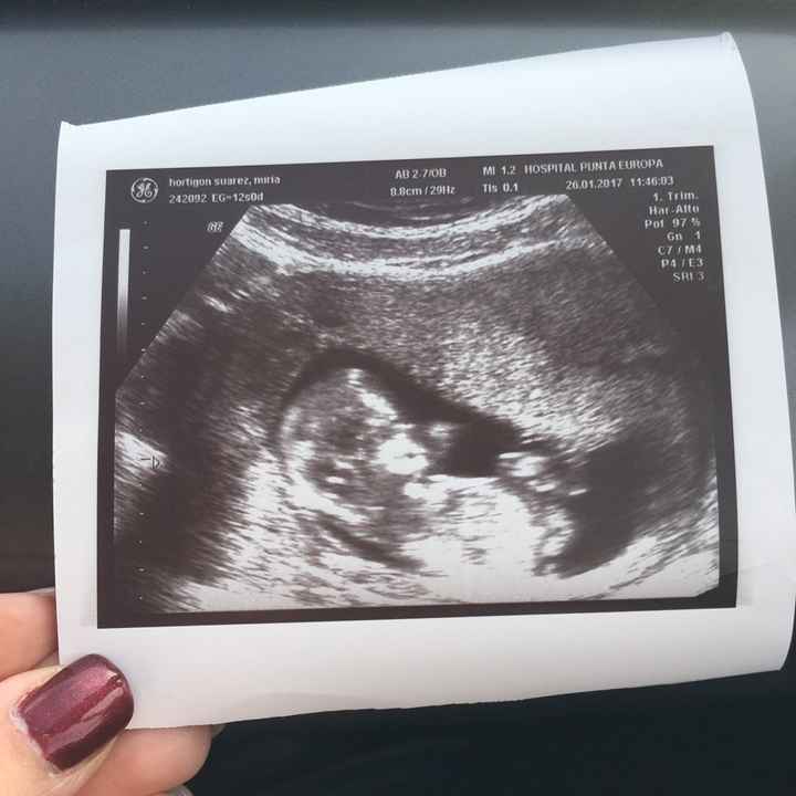 Mamis agosto 2017 - 1