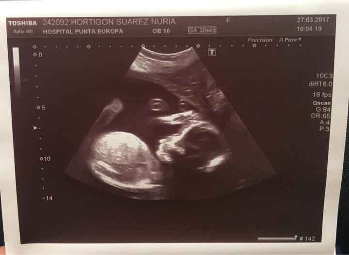 Mamis agosto 2017 - 1