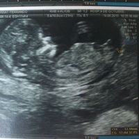 12 semanas2