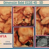 Futuras mamás Diciembre 2018 - 1