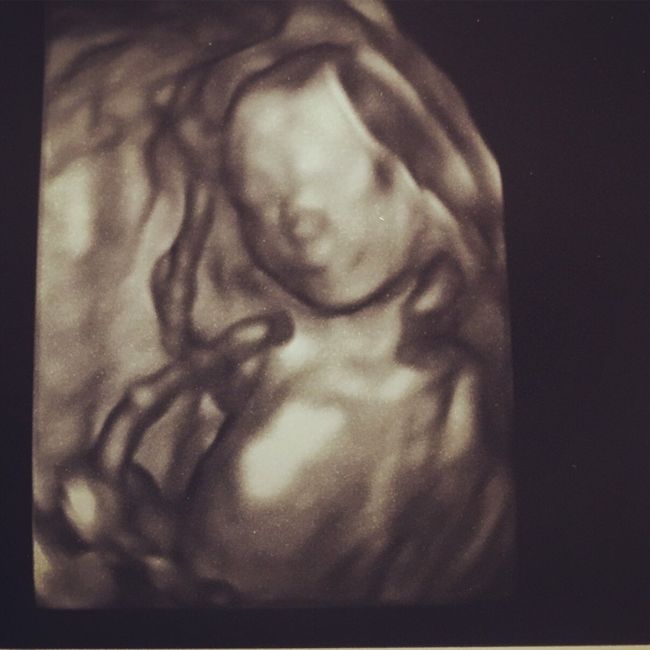 Futuras mamas julio 2016 - 3