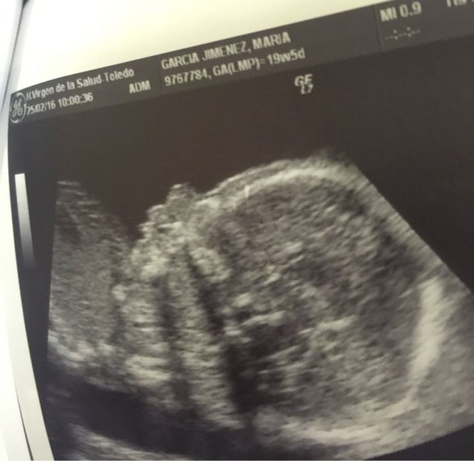 Futuras mamas julio 2016 - 1
