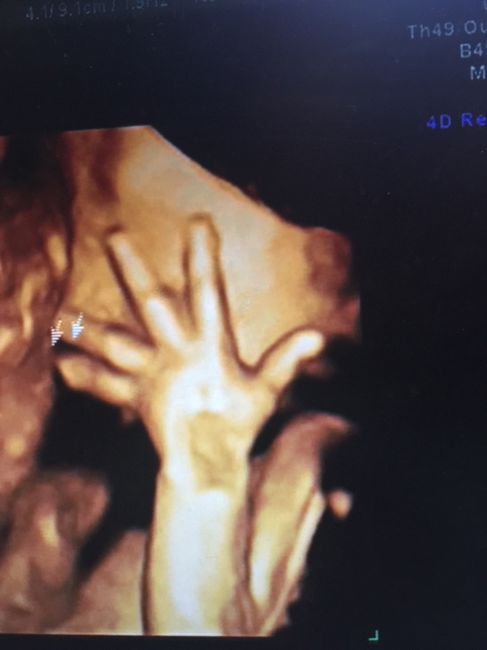 Futuras mamas julio 2016 - 1