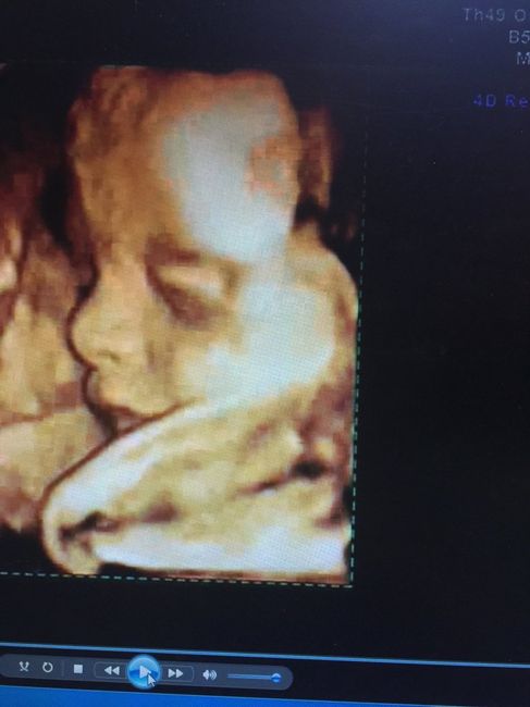 Futuras mamas julio 2016 - 2