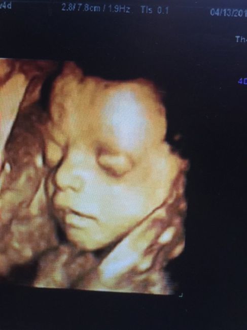 Futuras mamas julio 2016 - 3