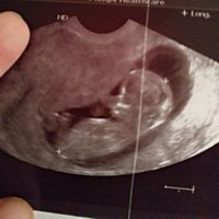 Ayuda con método ramzi: niño o niña? - 2