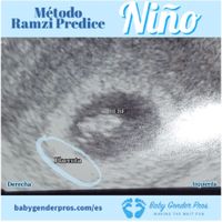 Ayuda con método ramzi: niño o niña? - 1