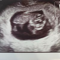 Futuras mamis Junio 2023 - 1