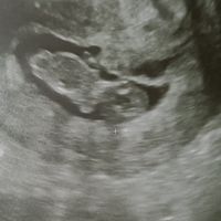 Futuras mamis Junio 2023 - 1