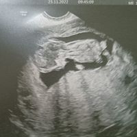 Futuras mamis Junio 2023 - 1