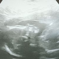 Futuras mamis Junio 2023 - 1