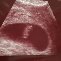 Mamis julio 2017 - 2