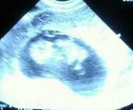 Mamas para julio 2015 :) - 1