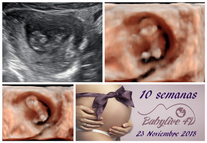 Futuras mamás Junio 2019 - 1
