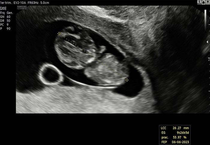 Futuras mamis Junio 2023 - 1