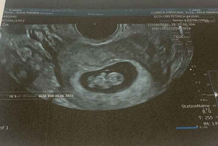 Futuras mamis Junio 2023 - 2