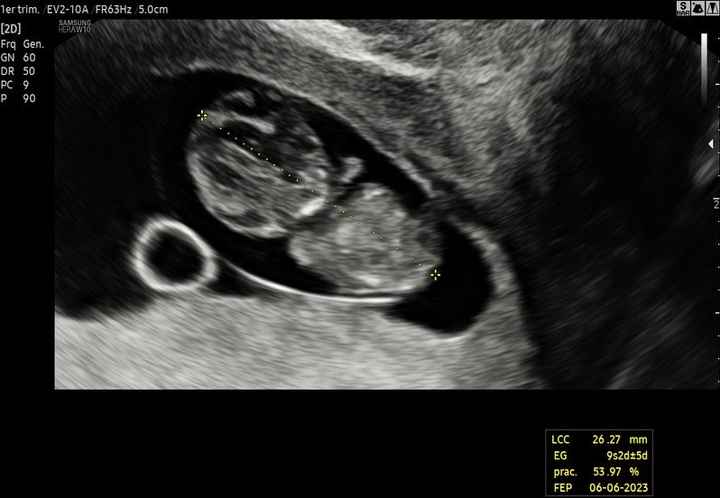 Futuras mamis Junio 2023 - 1