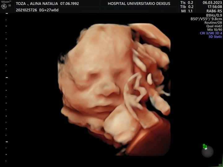 Futuras mamis Junio 2023 - 1