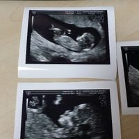12 semanas