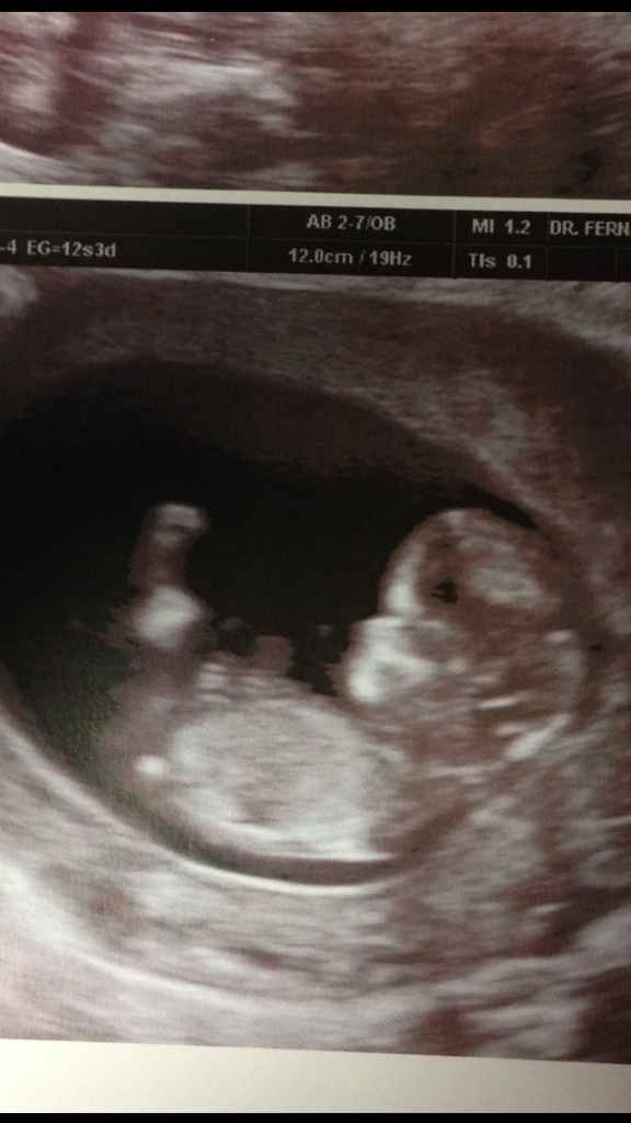 El consultorio de Lita para futuras mamis - 1