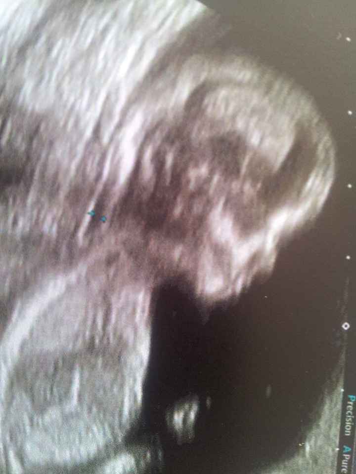 mi bebe